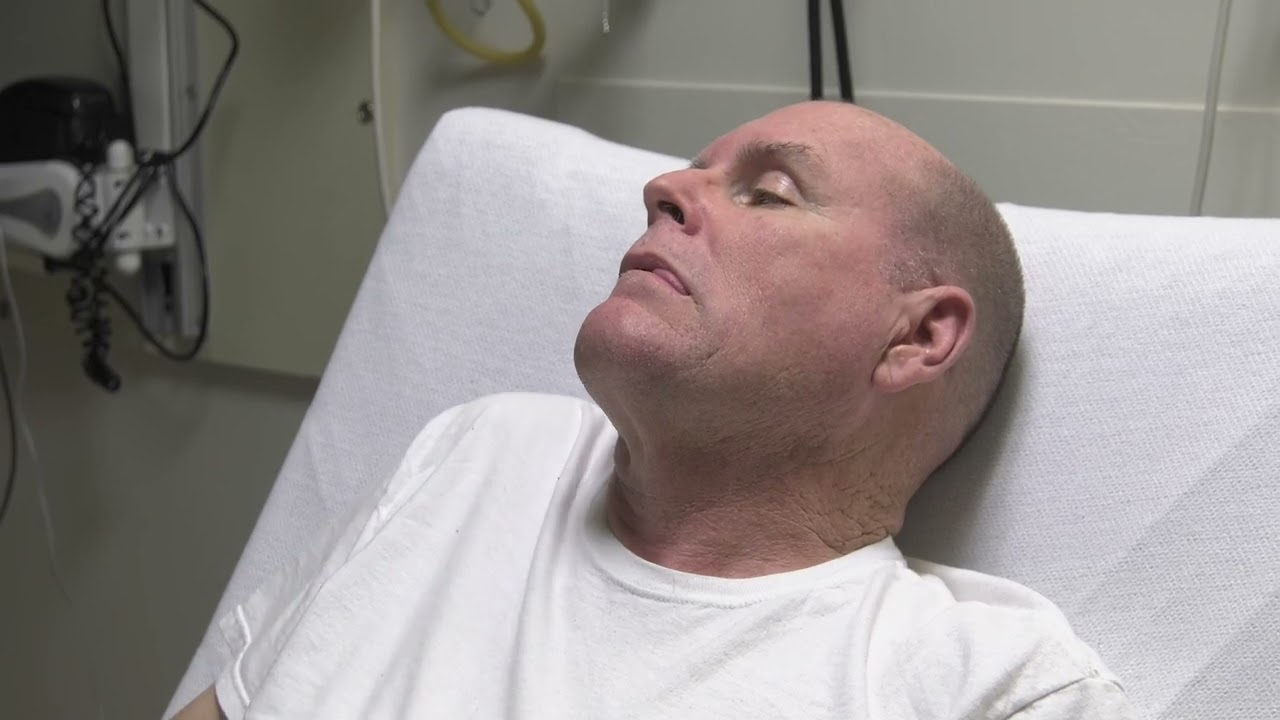 Dr. Ali Krisht Talks About the Signs of Stroke