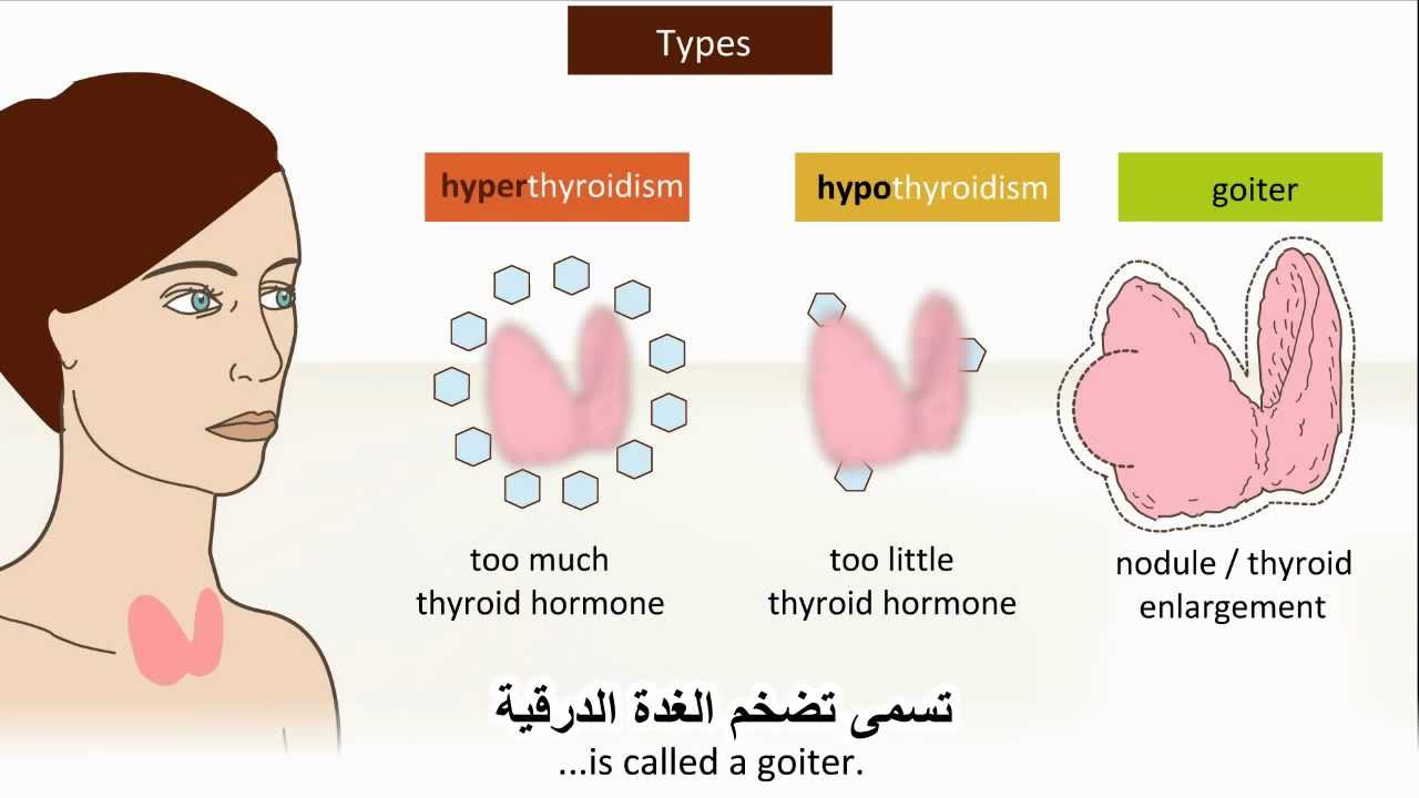 أعراض الغدة الدرقية النشطة