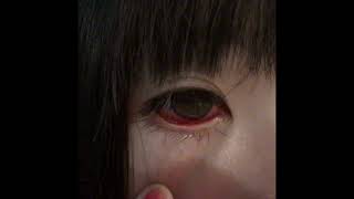 [FREE] *UNDERGROUND TRAP* PTITE SOEUR X NEOPHRON TYPEBEAT - "BLOODY" (prod. kiwizbeats)