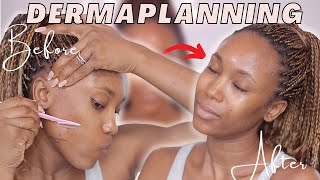 Do This For Instant Facial Glow And Clear, Smooth Skin | DIY Facial Dermaplanning For Clear Skin screenshot 5