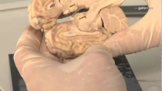 Das Gehirn: Diencephalon / Zwischenhirn