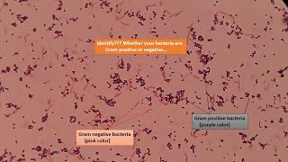 Gram positive and Gram negative bacterial slides under the Microscope