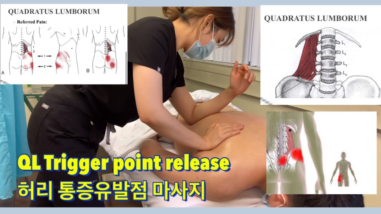 골반틀어짐 교정 허리 요방형근 마사지 하기 - 허리 통증유발점 뭉친근육 푸는법 단계별 설명- Quadratus Lumborum Trigger point release[ENGsub]