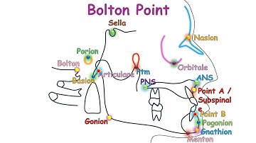 Cephalometric Landmarks (Animation)