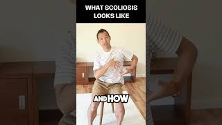 how scoliosis affects your body and functions