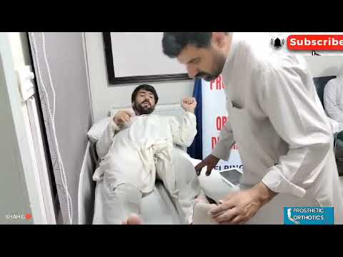 Understanding FFB:Femoral Fracture Bra.ce