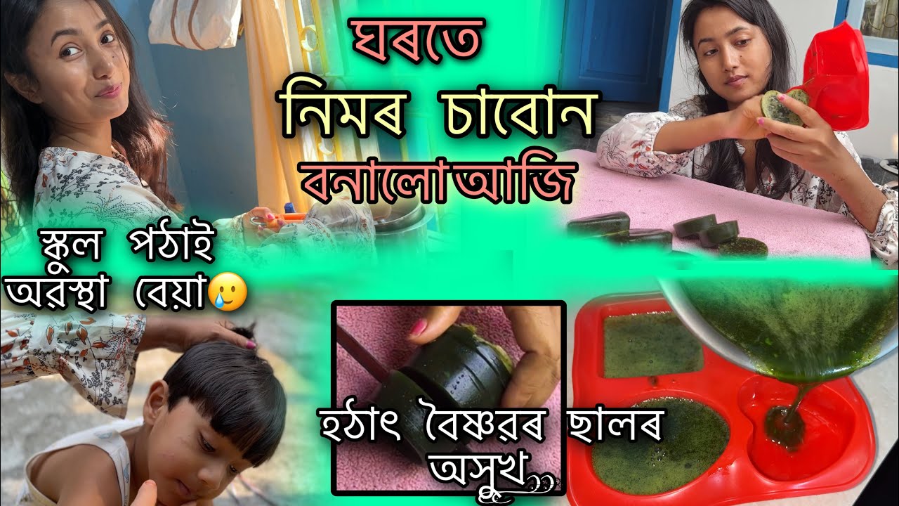 হঠাৎ বৈষ্ণৱৰ ছালৰ অসুখ🥲/সেইবাবে ঘৰতে বনালো আজি নিমৰ চাবোন🤩// result যে এনে হব কেতিয়াও ভবা নাছিলো