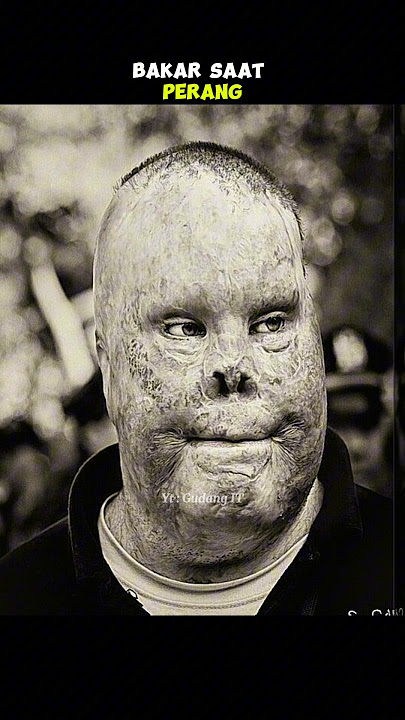 PERBEDAAN TENTARA SEBELUM DAN SESUDAH PERANG