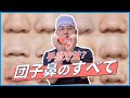 意外と知らない団子鼻矯正の全てを整形外科専門医が解説！【エートップ美容整形外科】