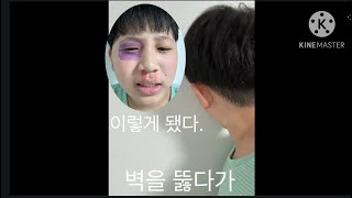 벽을 뚫다가 멍이 들었다.