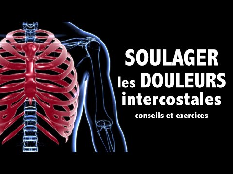 Vidéo: Dois-je déjouer mes côtes ?