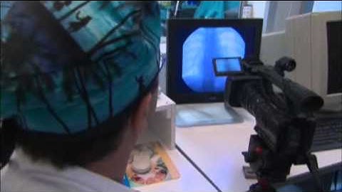 CCSVI DOKUMENTTI "LIBERATION TREATMENT" (suomenkiel.teksti)