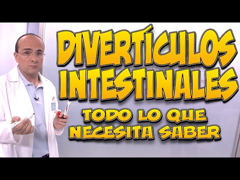 Video: ¿Todos tenemos divertículos?