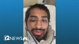 Hospital trying to identify man hit by a car