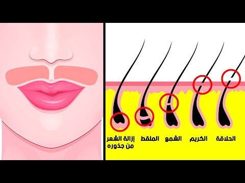 فيديو: كيفية إزالة الشعر بشكل طبيعي من وجهك: 9 خطوات