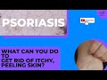 Psoriasis Treatments for You. Get Rid of That Itchy, Painful, Rash