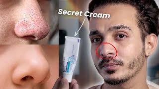 OMG! This Cream Erases Blackheads & Whiteheads Like Magic! 😱 screenshot 4