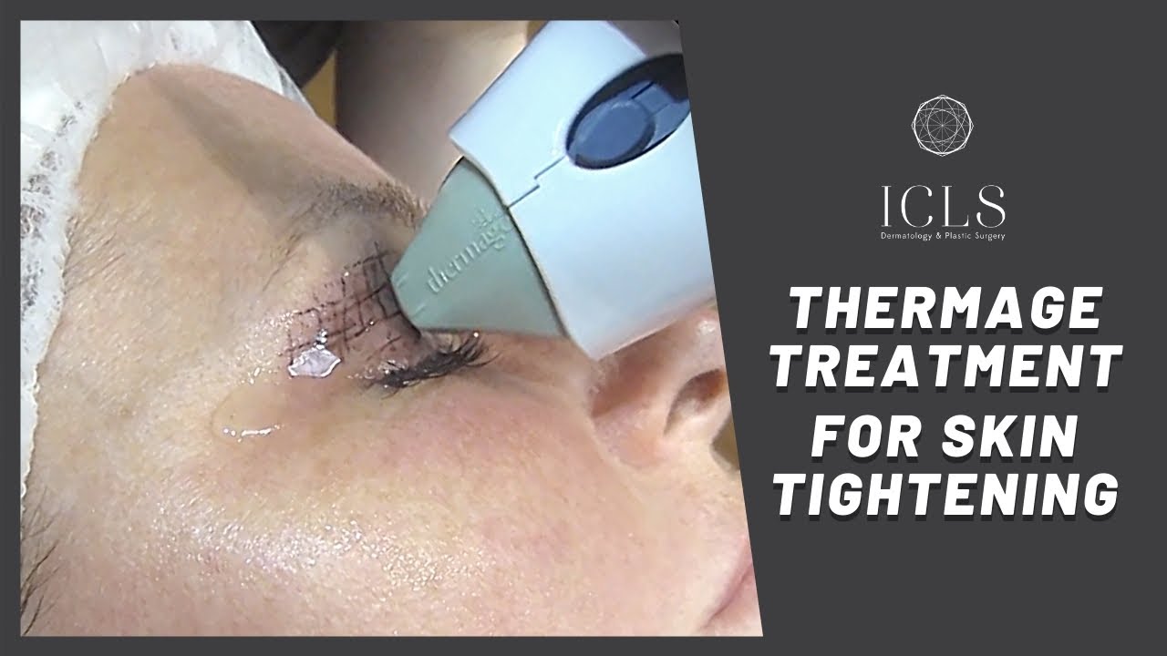 【極美品】Non-Surgical Skin Tightening and Li Skin Tightening in Oakville, Mississauga and Toronto | ICLS