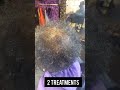 Natural Hair Growth Serum 6 Month Update #alopecia #hairgrowth #haircare #hairloss