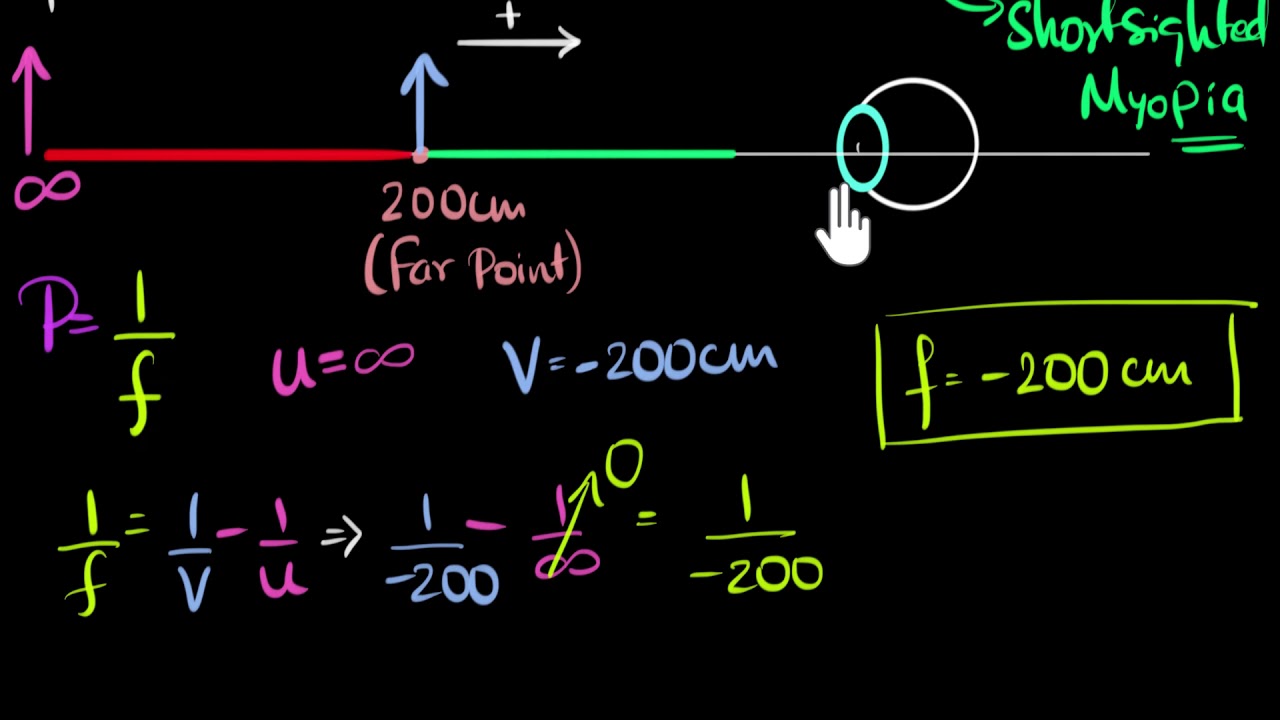 Numerical on myopia