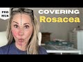 How to Cover Rosacea: different methods