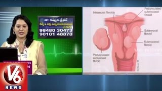 Gynec Problems | Fibroids | Reasons And Treatment | Dr Kammela Sridevi | Good Health | V6 News