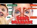 Lets drain those sinuses naturally shal we tutorial sinus