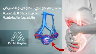 Pelvic Congestion Syndrome | Dr. Ali Haydar | دوالي الحوض والمبيض