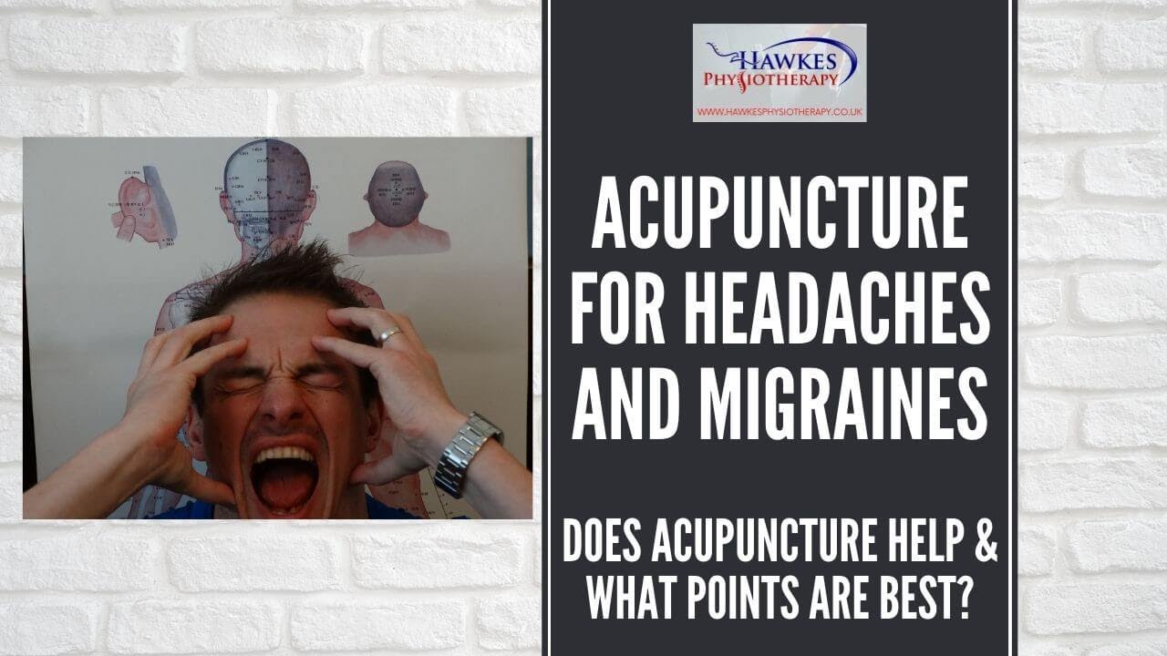 Acupuncture for headaches and migraines Does acupuncture help & what
