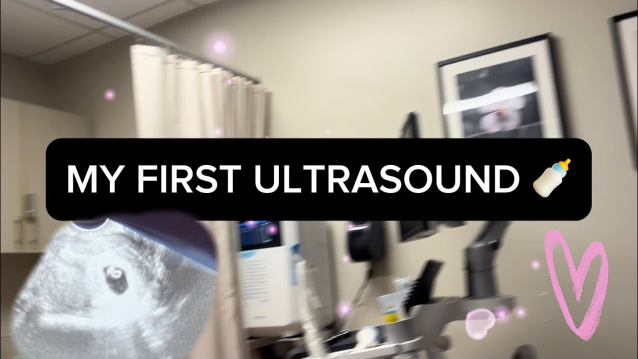 OUR FIRST ULTRASOUND 6 weeks - YouTube