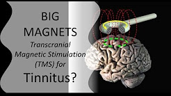 BIG Magnets for Tinnitus - Does TMS-TransCranial Magnetic Stim. (TMS) work? [CR Neuromod. pt 7]