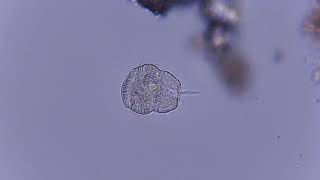 Urocentrum turbo, a cool ciliate