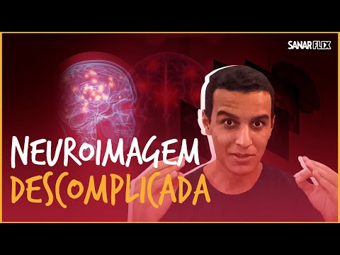 Vídeo: Neuroimagem Funcional E Coreia: Uma Revisão Sistemática