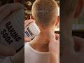 The "Hidden" Solution for a Dark Neck #shortsvideo  Educational only. Not medical advice.