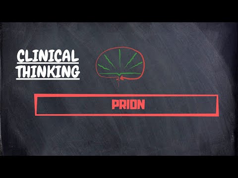 Prion | Clinical Thinking