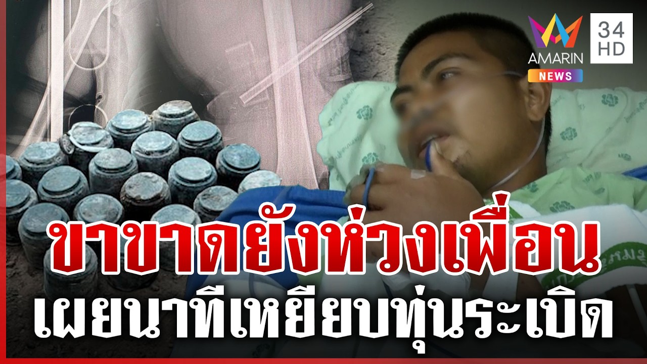 อัปเดตอาการ 