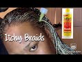 How to relieve itchy braids in 2 minutes demo samanthaaa cabey