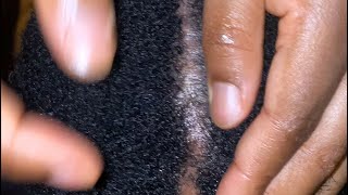 ASMR 🫦 Soft scalp care, scratching, oiling, soft whispers and gum chewing ASMR to make you sleep