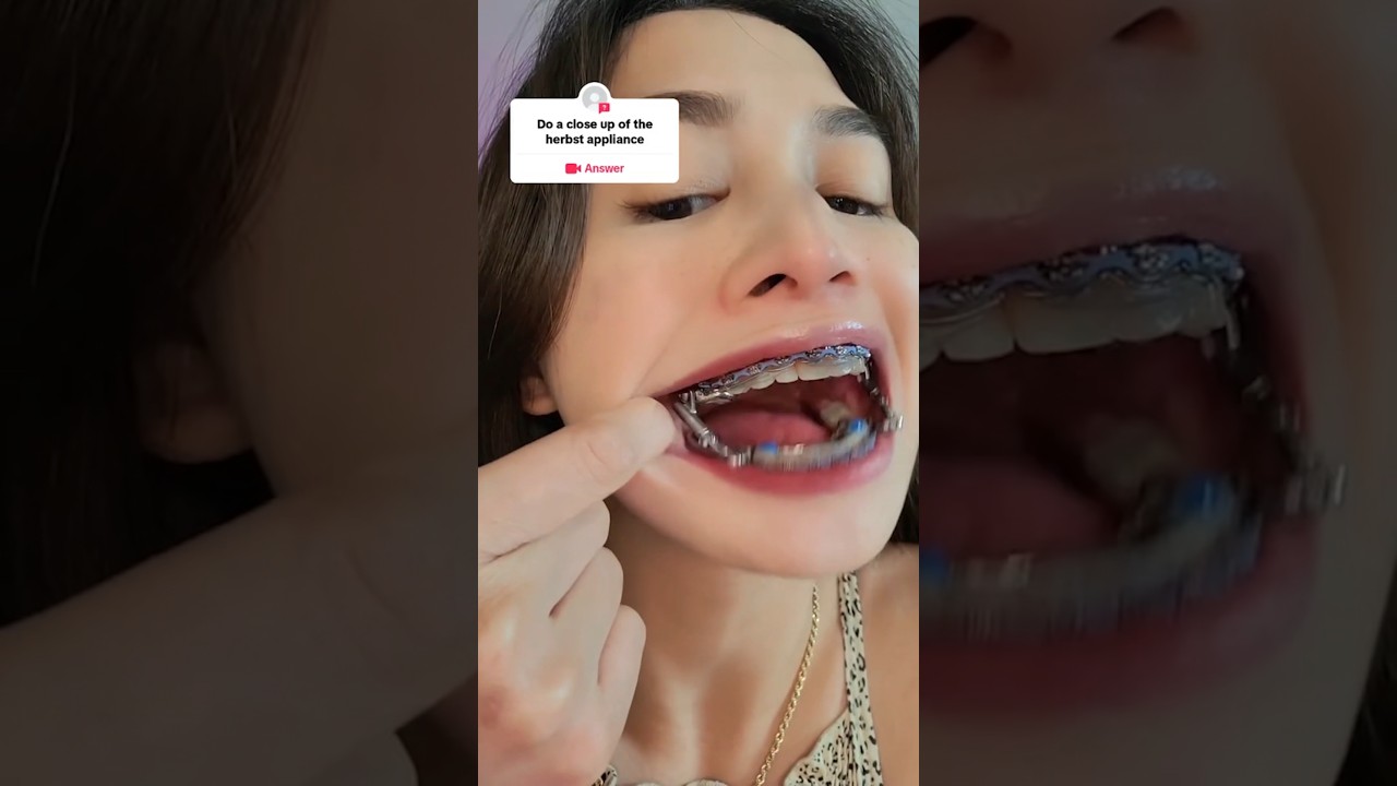 Her Entire Mouth Is Metal!