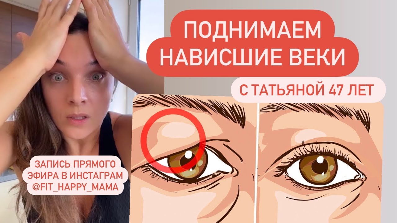 Нависшие верхние веки - YouTube