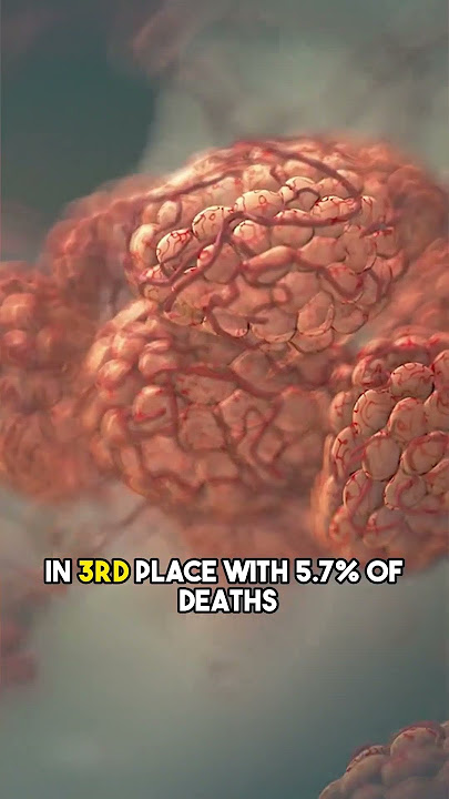 The Deadliest Diseases in the World