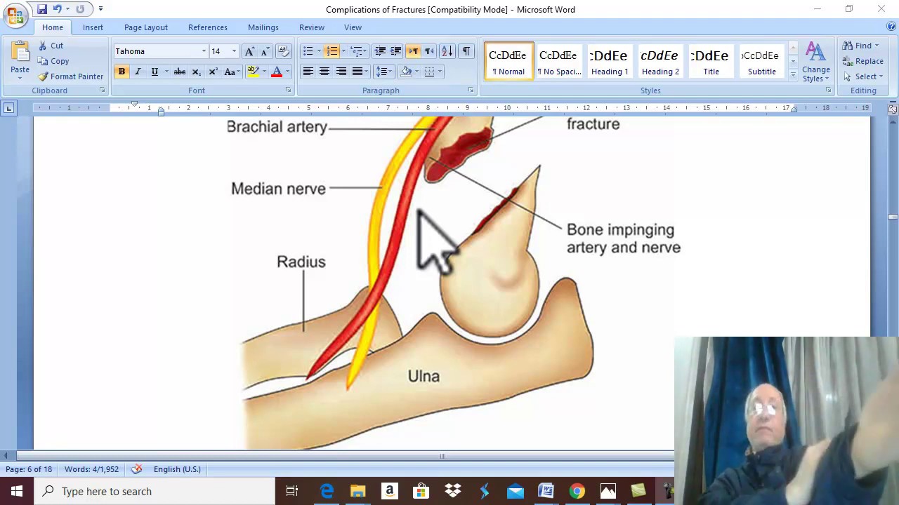 Orthopedic in Arabic 7 (  Complications of fractures , part 2 ) , by Dr. Wahdan .