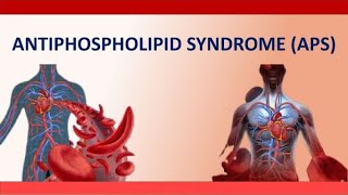 Antiphospholipid Syndrome (APS) / What Is APS and how to Manage It during Pregnancy?