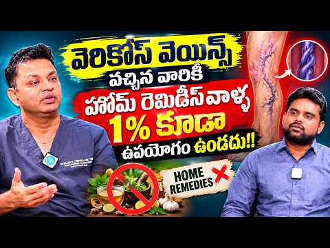 Stop Trying Home Remedies For Varicose Veins!  | Dr. Raja V Koppala | Avis Hospitals | iDream - IDREAMMEDIA