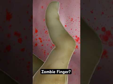Why This Finger Looks Like a Zombie’s