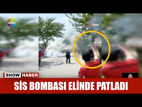 Sis bombası elinde patladı