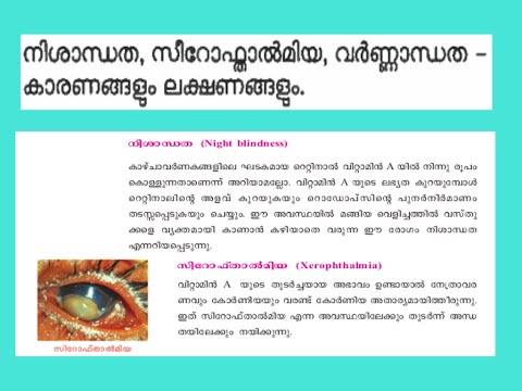 നിശാന്ധത ,സിറോഫ്താൽമിയ , വർണ്ണാന്ധത – കാരണങ്ങളും ലക്ഷണങ്ങളും