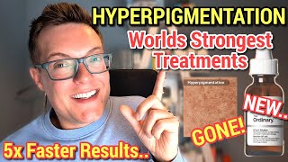 WORLDS STRONGEST HYPERPIGMENTATION SERUMS - Remove Dark Spots Fast