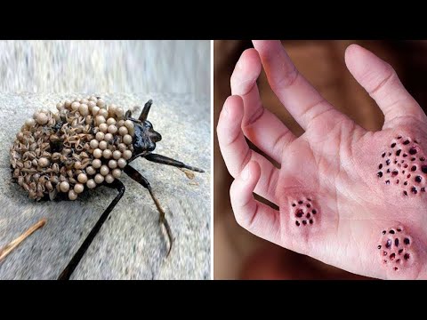 Video: Peygamberdevesinin Çekilmesi - Bahçelerde Haşere Kontrolü İçin Peygamberdevesi Kullanımı