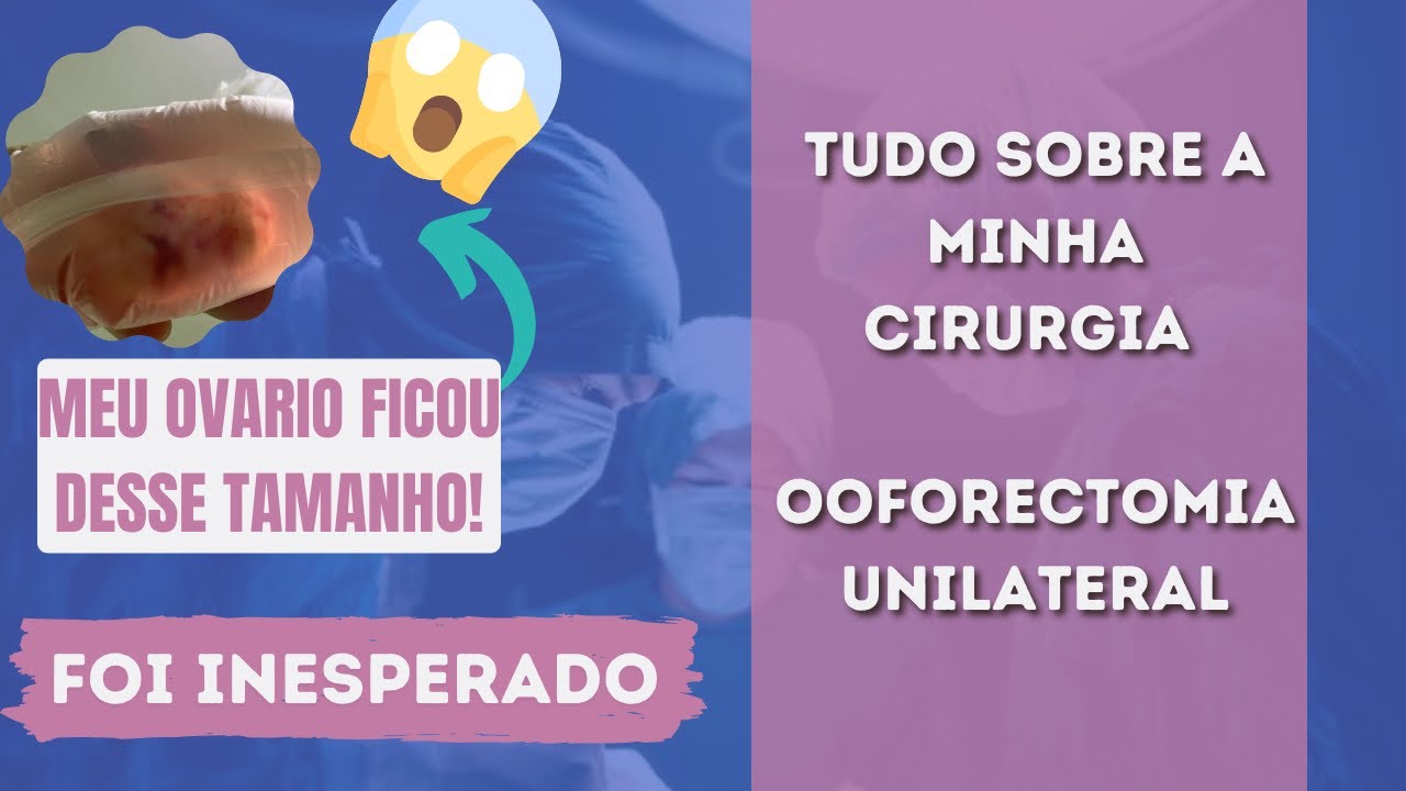 Ooforectomia: cirurgia para retirada dos ovários - Minha Vida